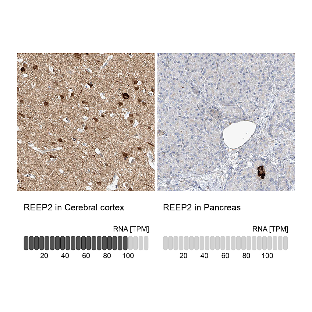 Atlas Antibodies Anti-REEP2 Antibody