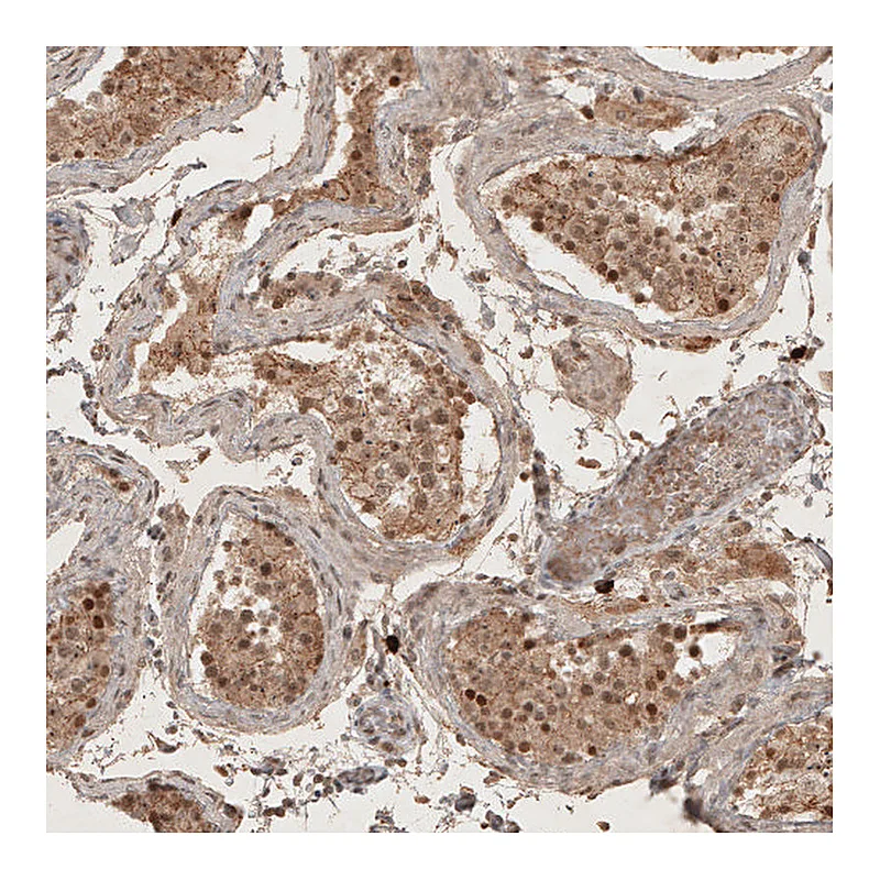Atlas Antibodies Anti-RECQL5 Antibody