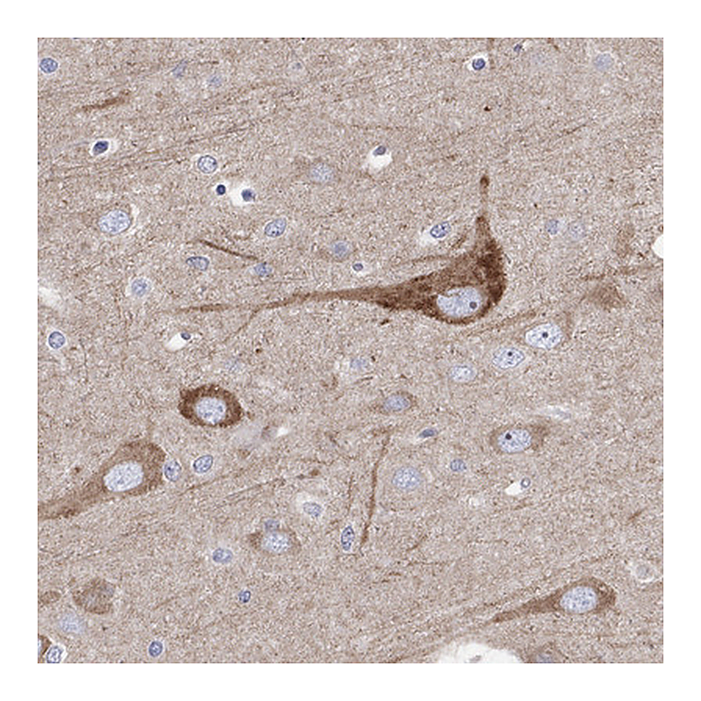 Atlas Antibodies Anti-REEP2 Antibody