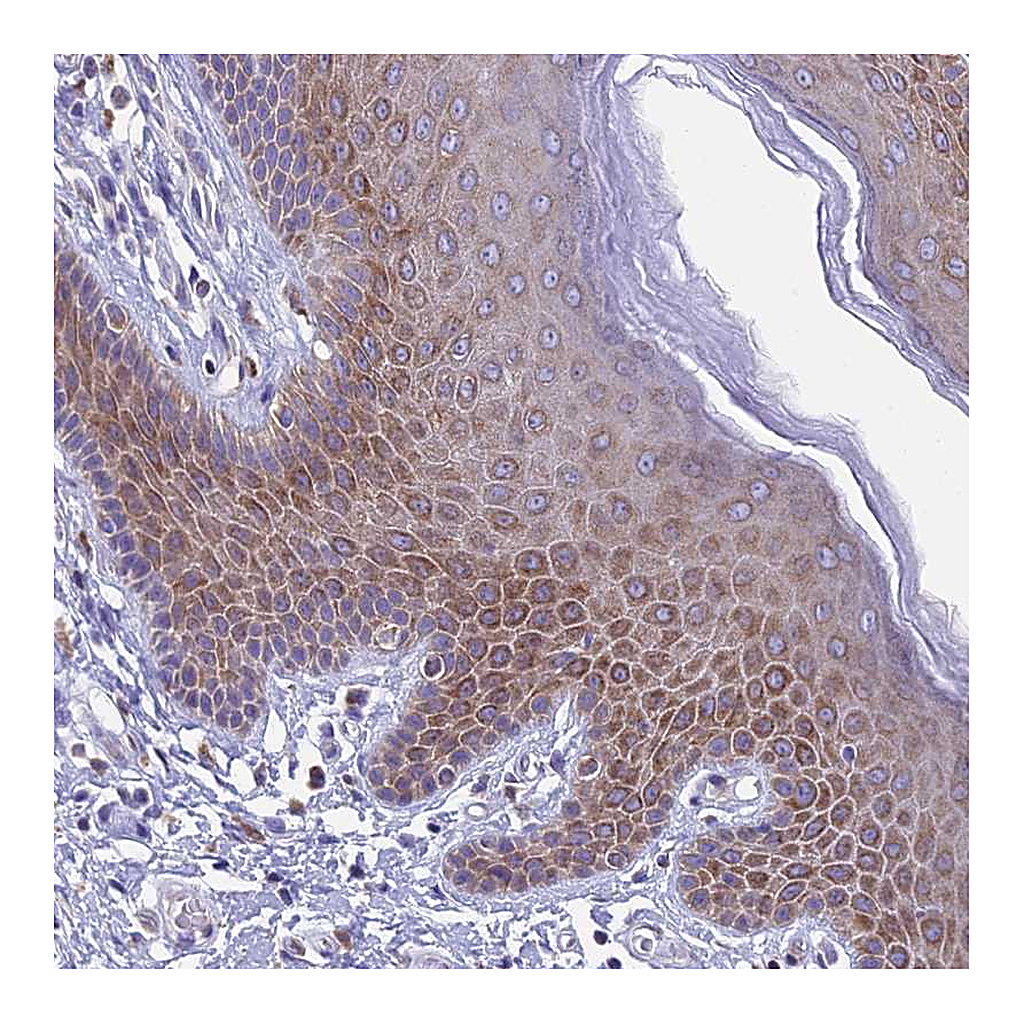 Atlas Antibodies Anti-REEP4 Antibody