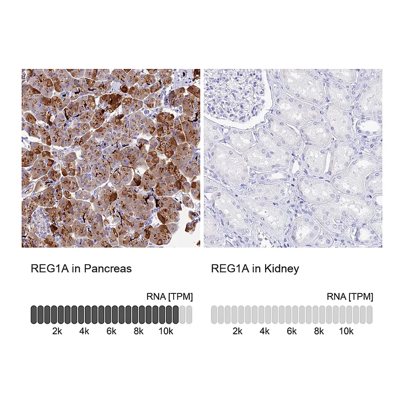Atlas Antibodies Anti-REG1A Antibody