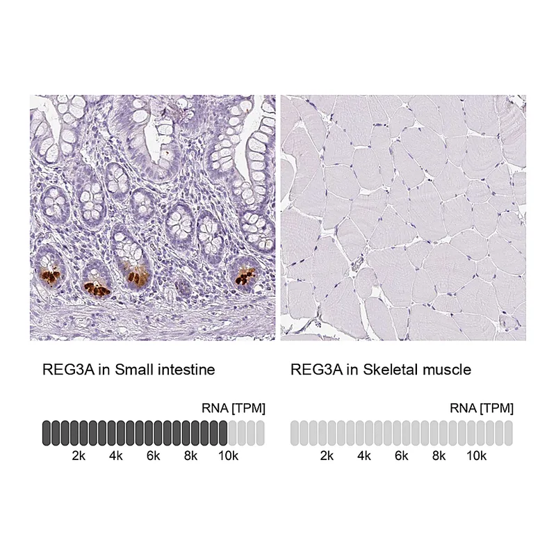 Atlas Antibodies Anti-REG3A Antibody