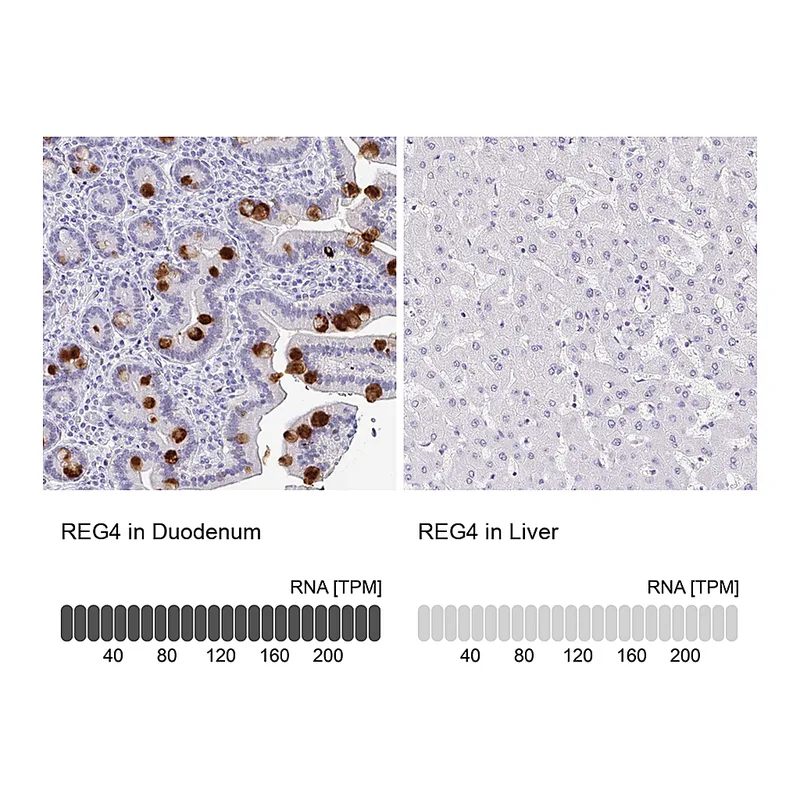Atlas Antibodies Anti-REG4 Antibody