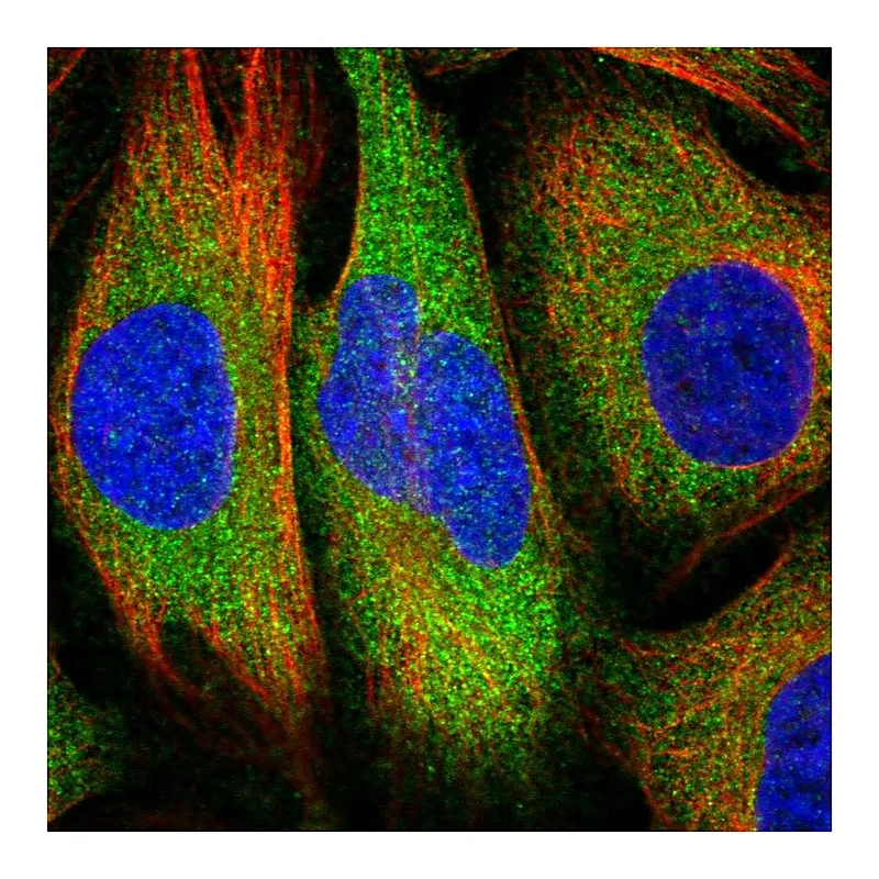 Atlas Antibodies Anti-RELA Antibody