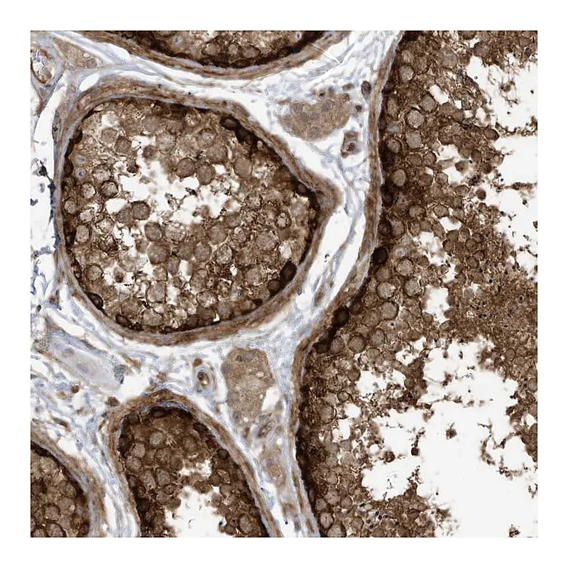 Atlas Antibodies Anti-REPS1 Antibody