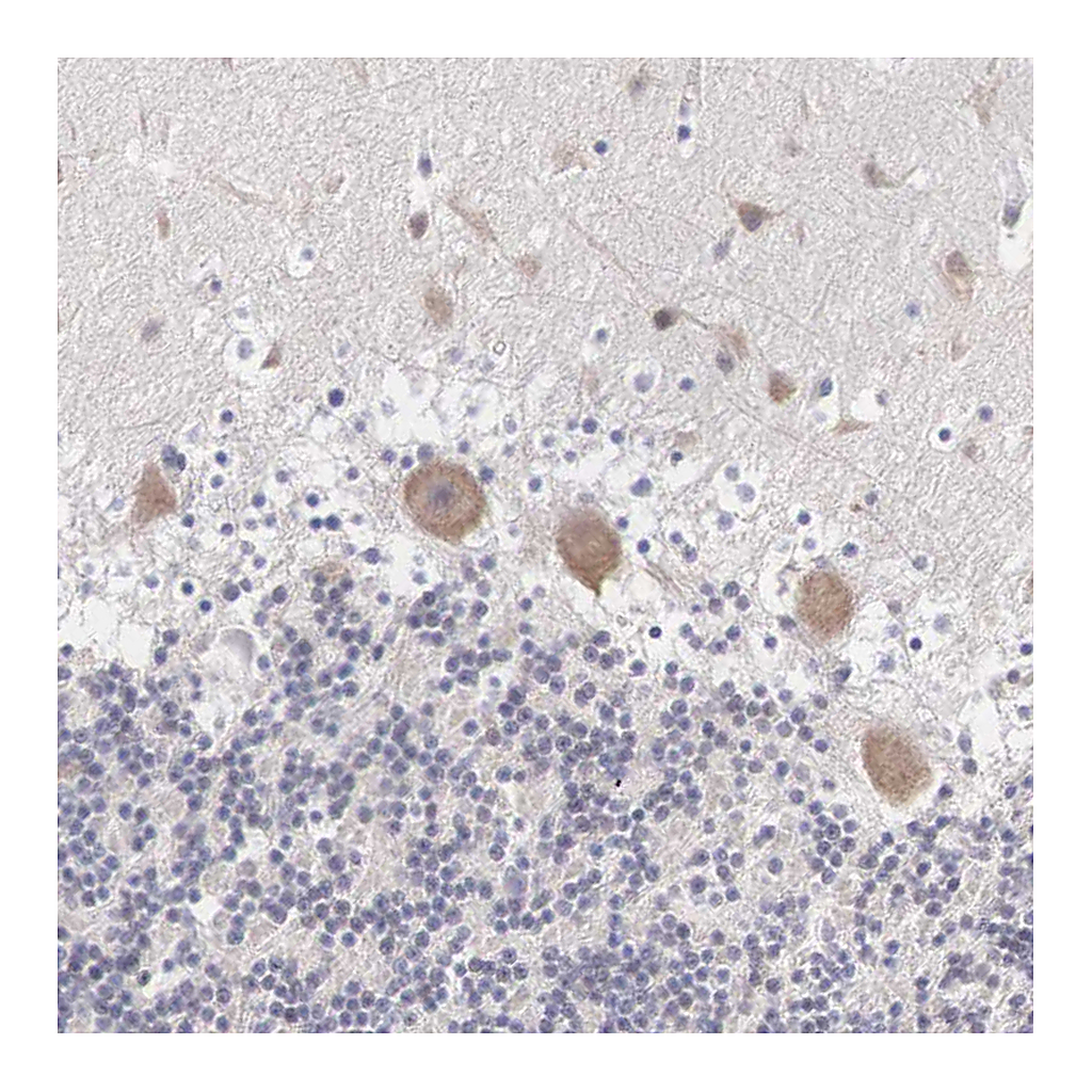Atlas Antibodies Anti-REPS2 Antibody