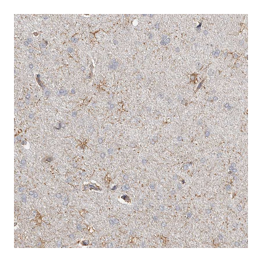 Atlas Antibodies Anti-REPS2 Antibody