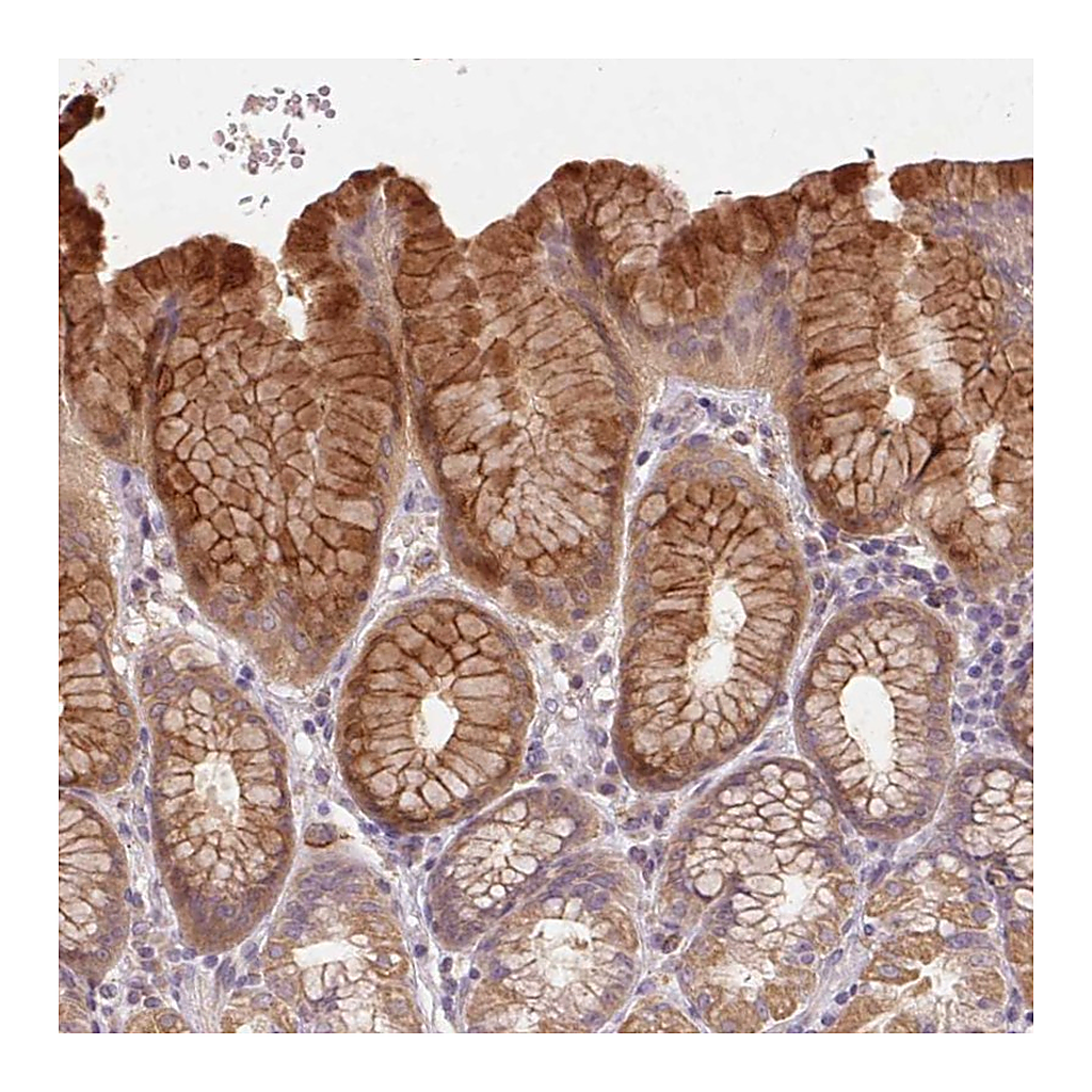 Atlas Antibodies Anti-REP15 Antibody