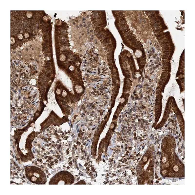 Atlas Antibodies Anti-REP15 Antibody