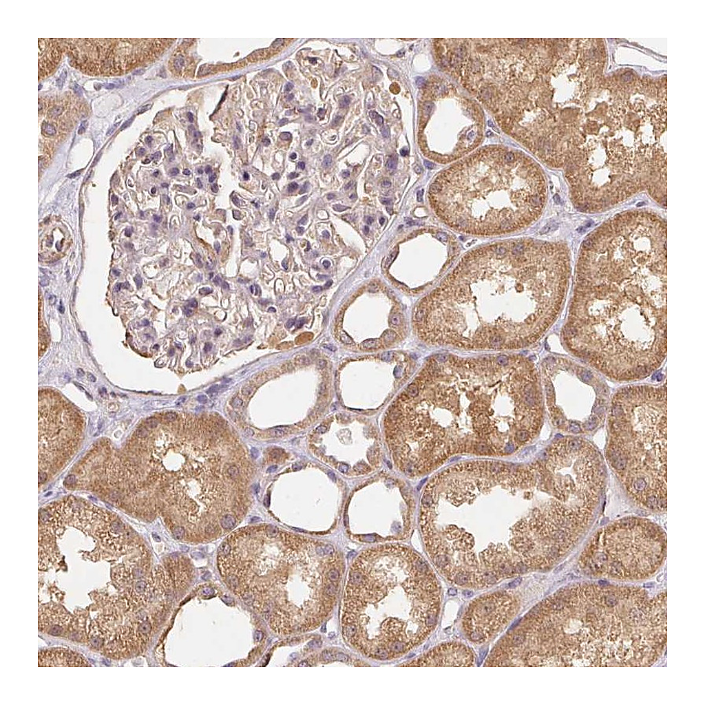 Atlas Antibodies Anti-REV3L Antibody