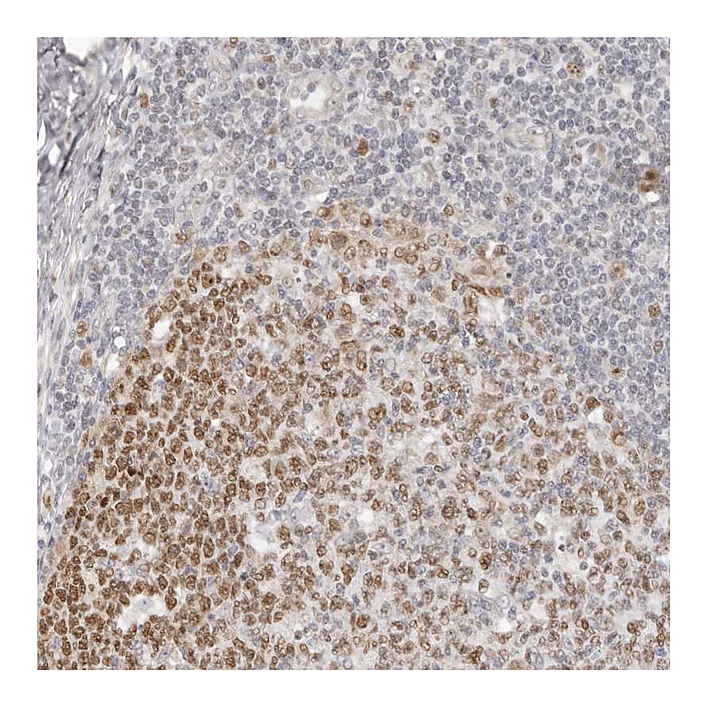 Atlas Antibodies Anti-RFC2 Antibody