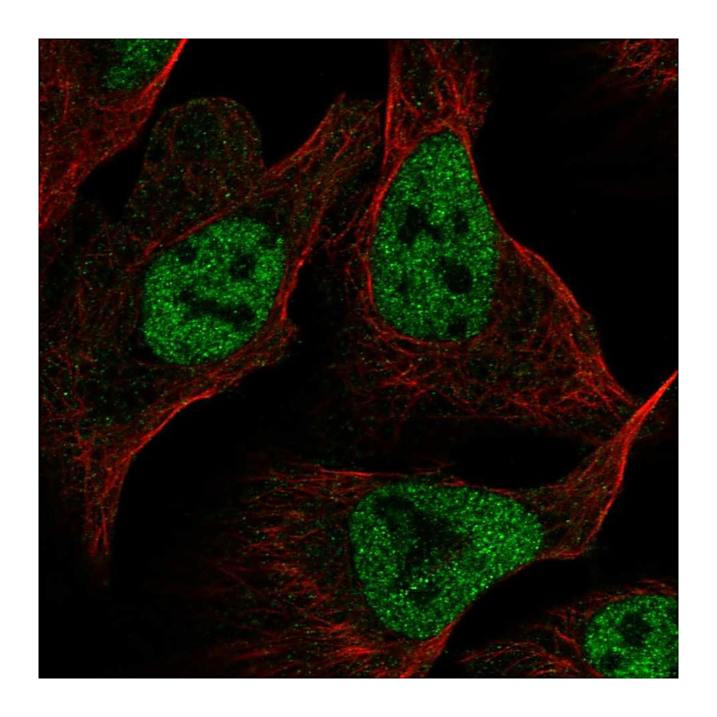 Atlas Antibodies Anti-RFC1 Antibody
