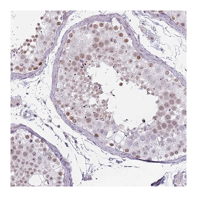 Atlas Antibodies Anti-REXO4 Antibody