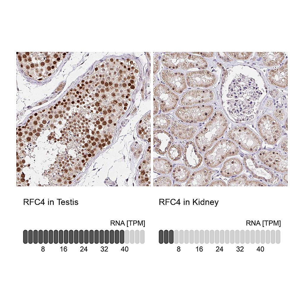 Atlas Antibodies Anti-RFC4 Antibody