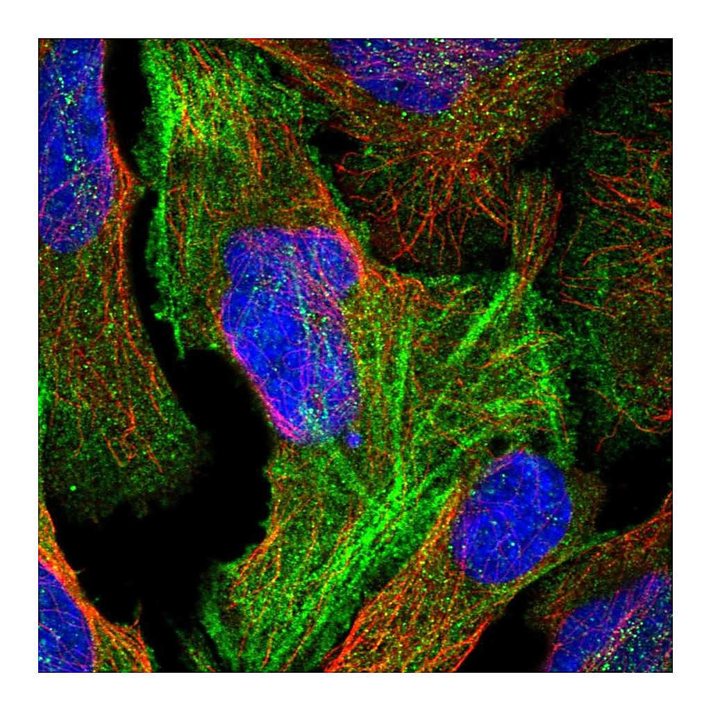 Atlas Antibodies Anti-RFLNB Antibody