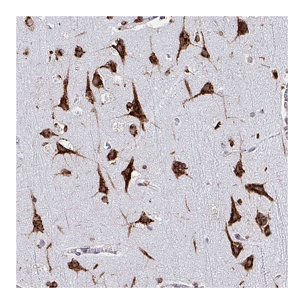Atlas Antibodies Anti-RFK Antibody