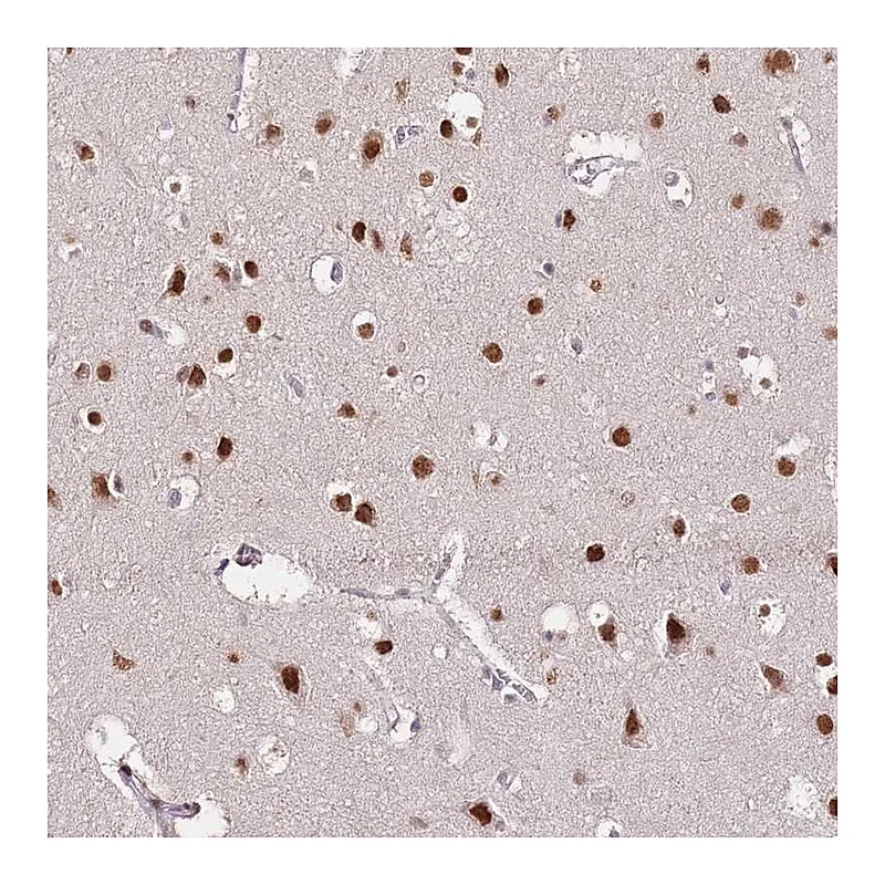 Atlas Antibodies Anti-RFK Antibody