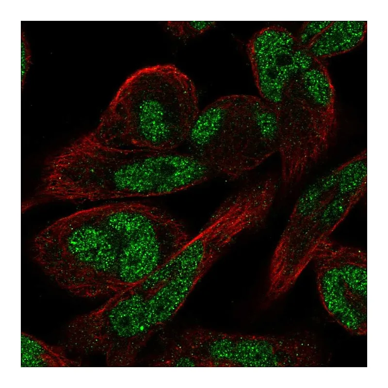 Atlas Antibodies Anti-RFLNA Antibody