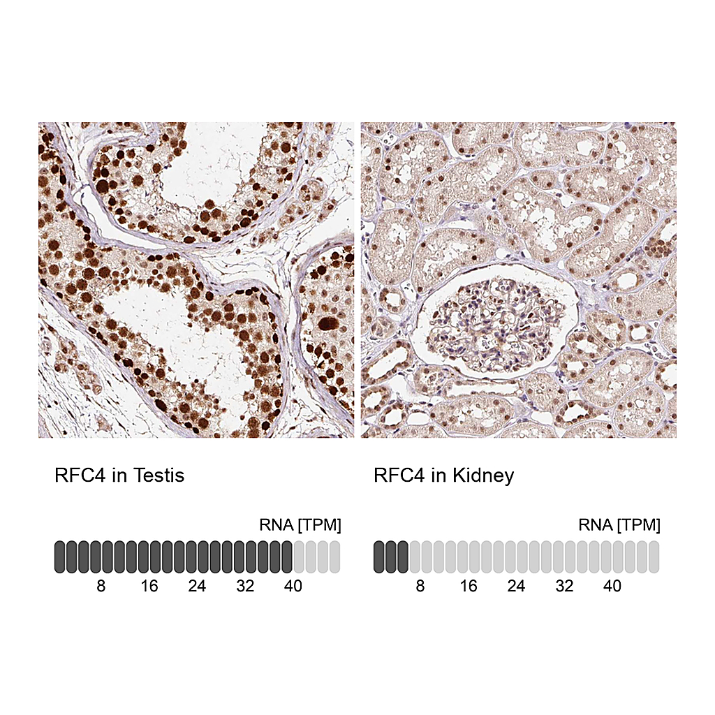 Atlas Antibodies Anti-RFC4 Antibody