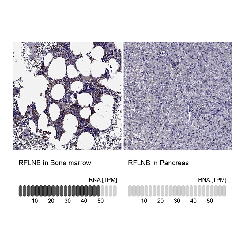 Atlas Antibodies Anti-RFLNB Antibody