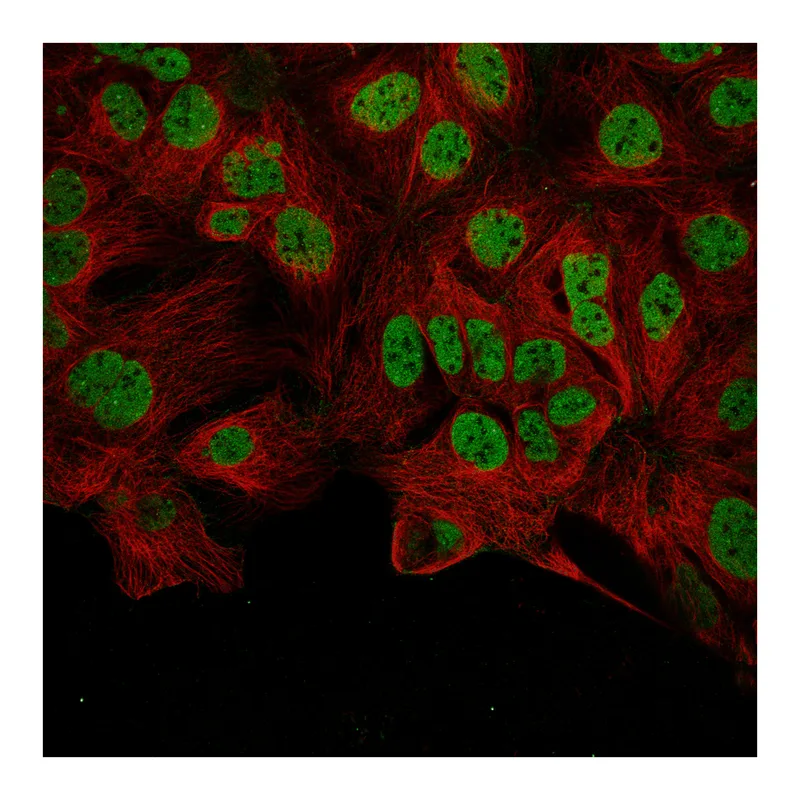 Atlas Antibodies Anti-RFWD3 Antibody