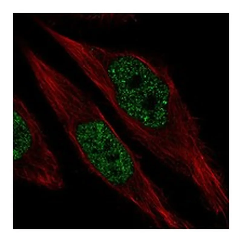 Atlas Antibodies Anti-RFX1 Antibody