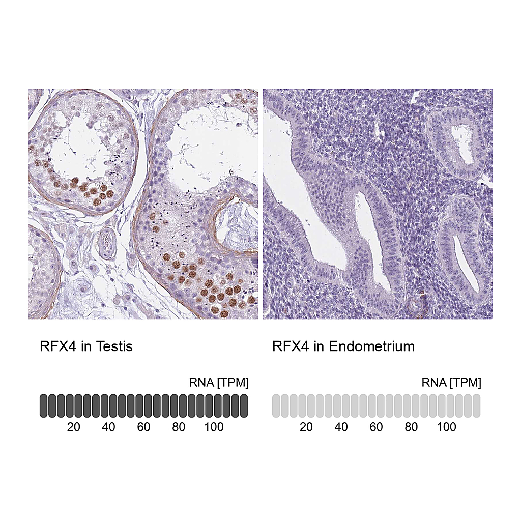 Atlas Antibodies Anti-RFX4 Antibody