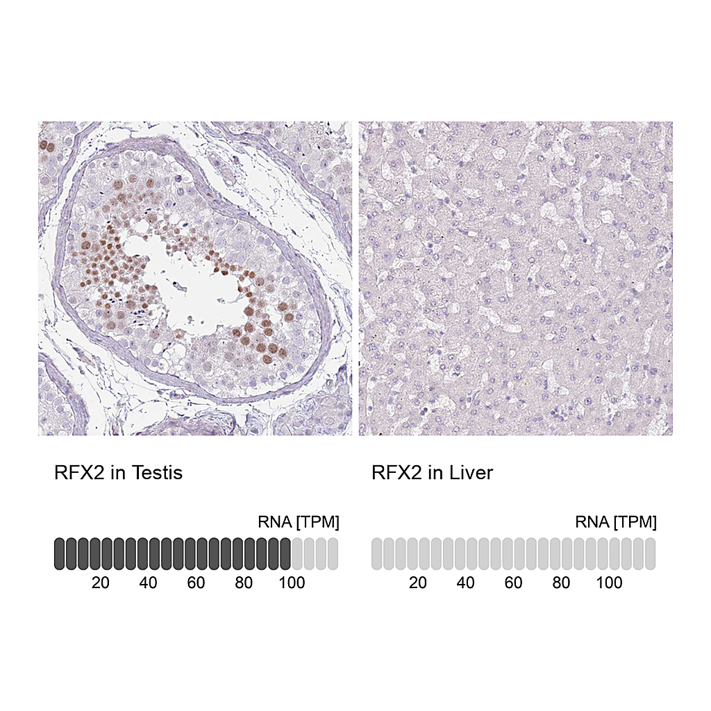 Atlas Antibodies Anti-RFX2 Antibody