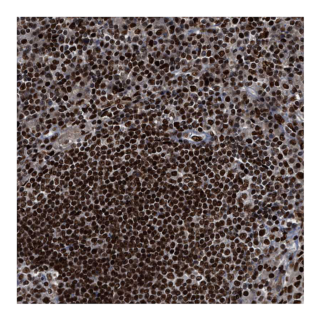 Atlas Antibodies Anti-RFX5 Antibody