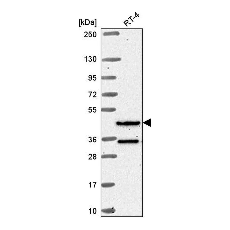 Atlas Antibodies Anti-RFX8 Antibody