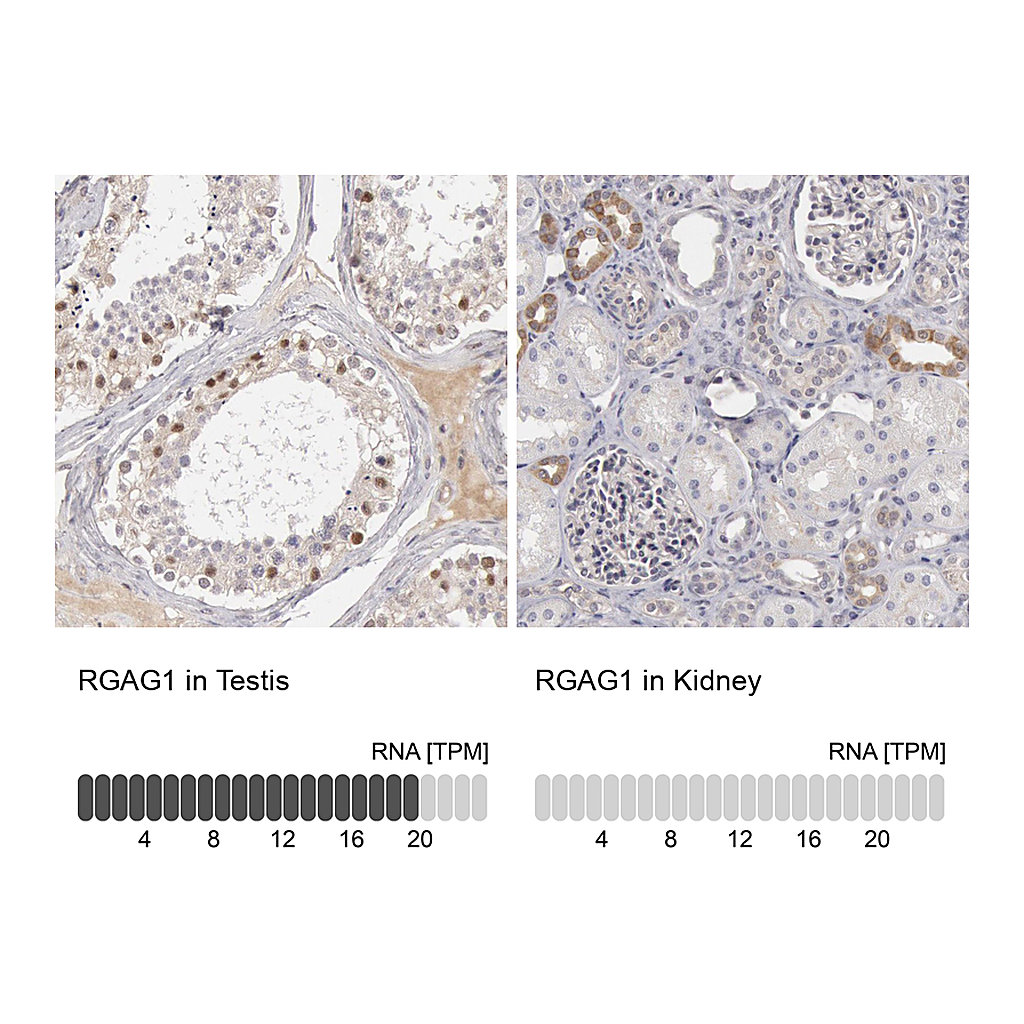 Atlas Antibodies Anti-RGAG1 Antibody