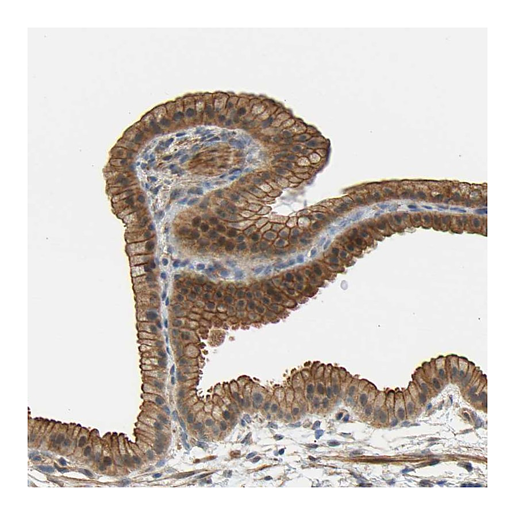 Atlas Antibodies Anti-RGL1 Antibody