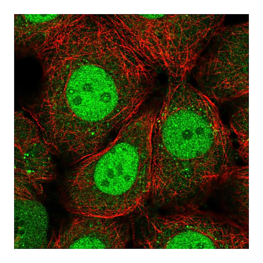Atlas Antibodies Anti-RFXANK Antibody
