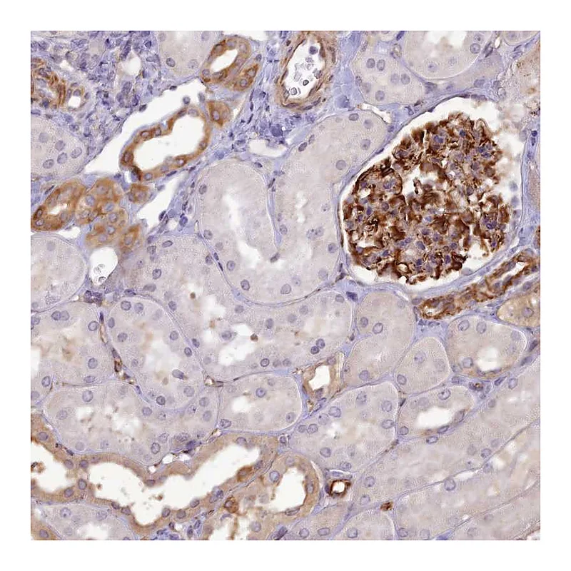 Atlas Antibodies Anti-RGL3 Antibody