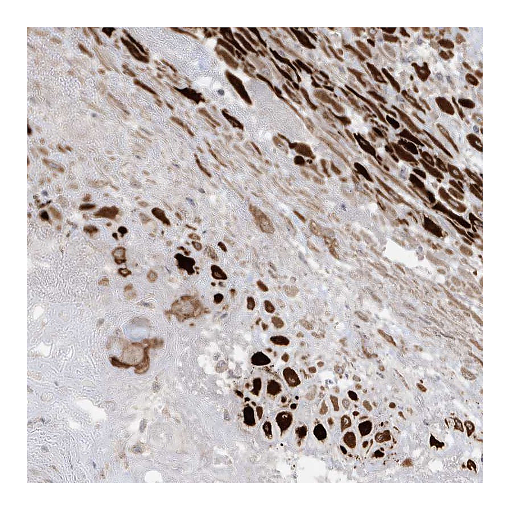 Atlas Antibodies Anti-RGL4 Antibody