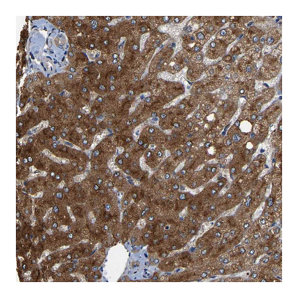 Atlas Antibodies Anti-RGP1 Antibody