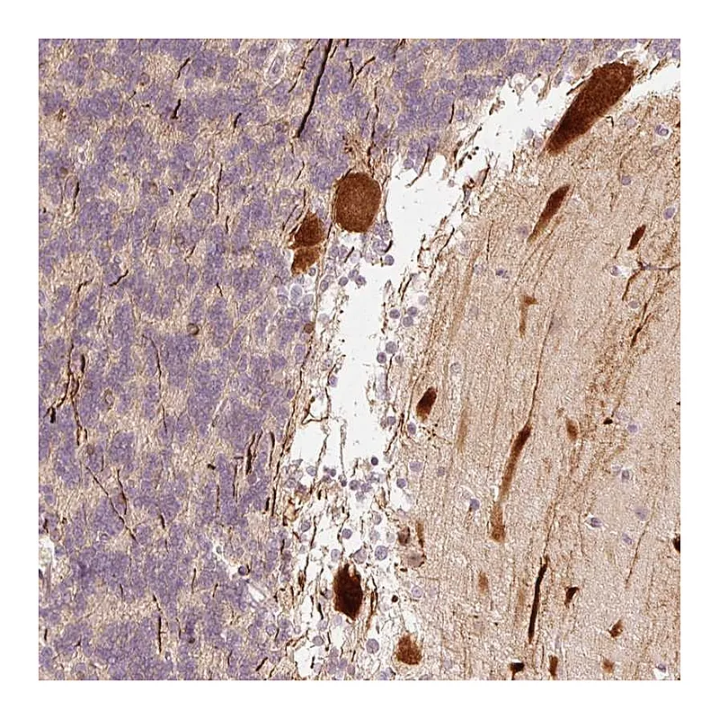 Atlas Antibodies Anti-RGPD5 Antibody