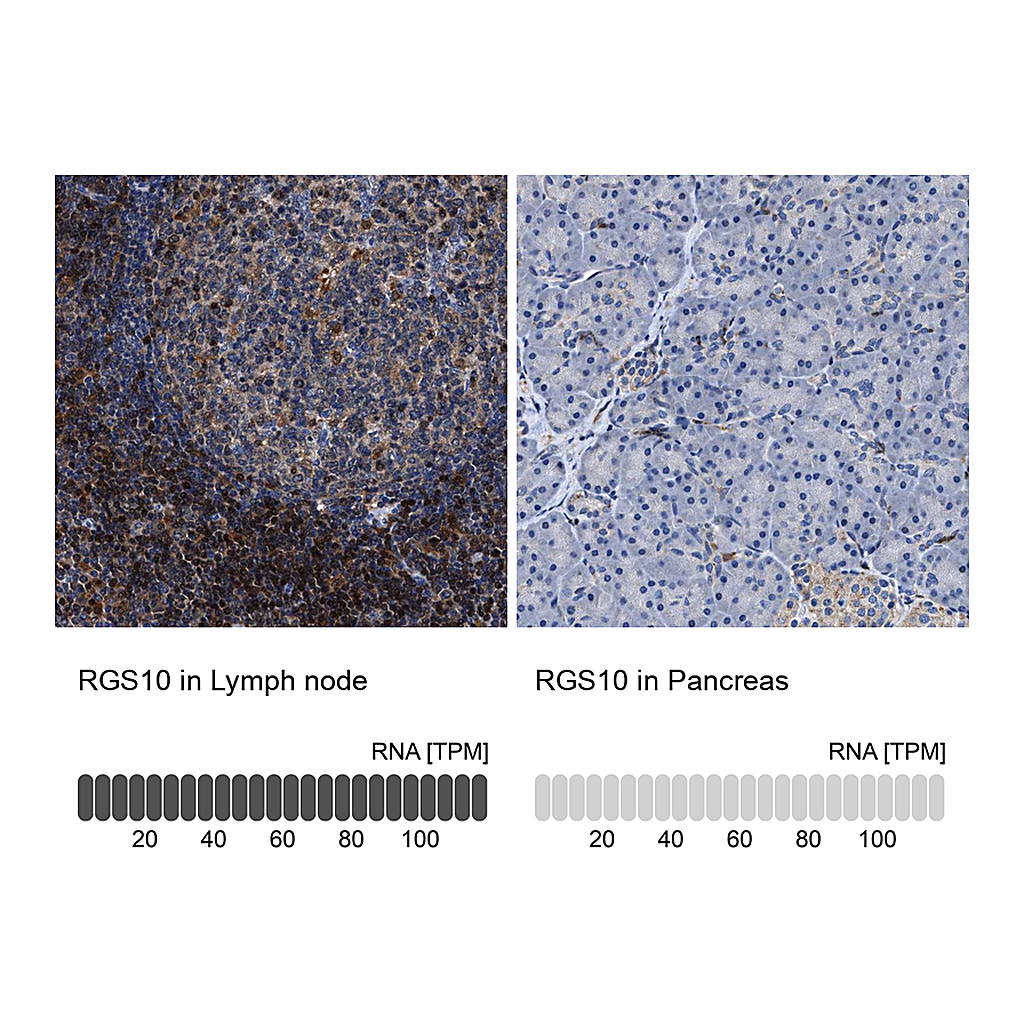 Atlas Antibodies Anti-RGS10 Antibody