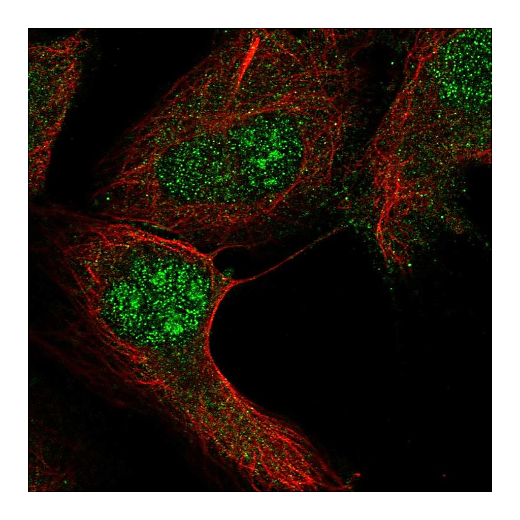 Atlas Antibodies Anti-RGS12 Antibody