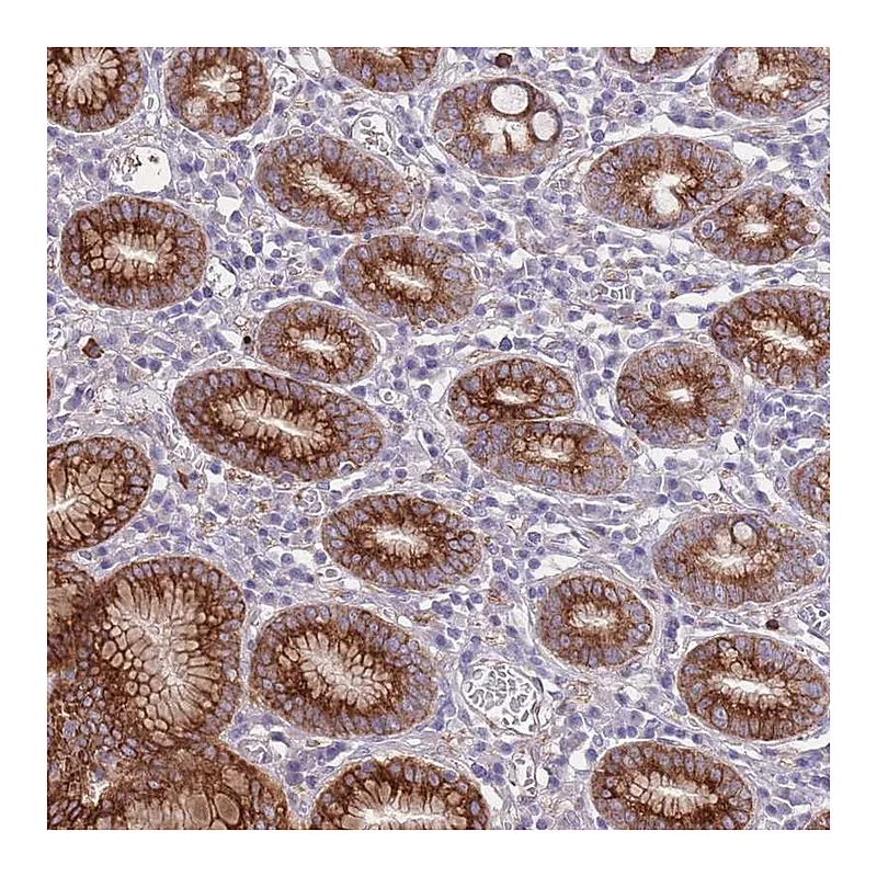 Atlas Antibodies Anti-RGS11 Antibody