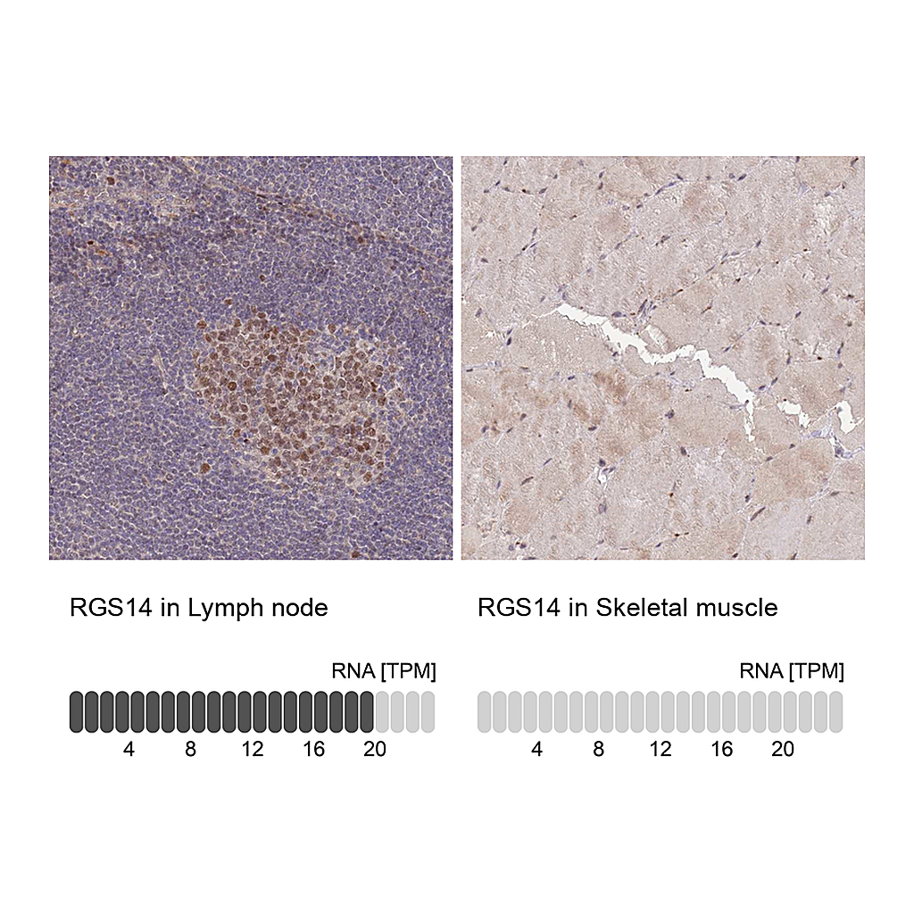 Atlas Antibodies Anti-RGS14 Antibody