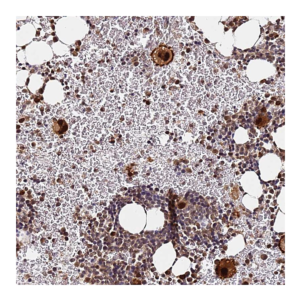 Atlas Antibodies Anti-RGS18 Antibody