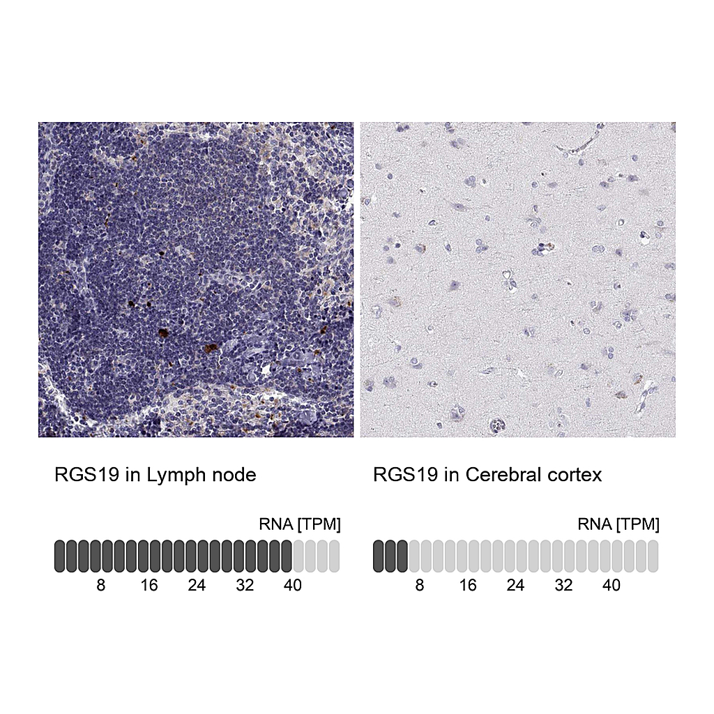 Atlas Antibodies Anti-RGS19 Antibody