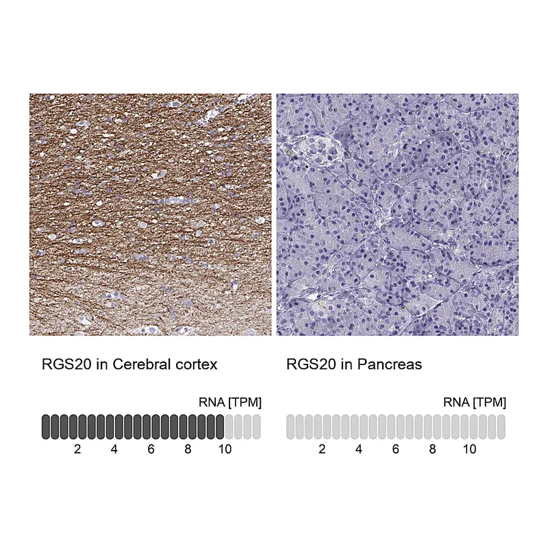 Atlas Antibodies Anti-RGS20 Antibody