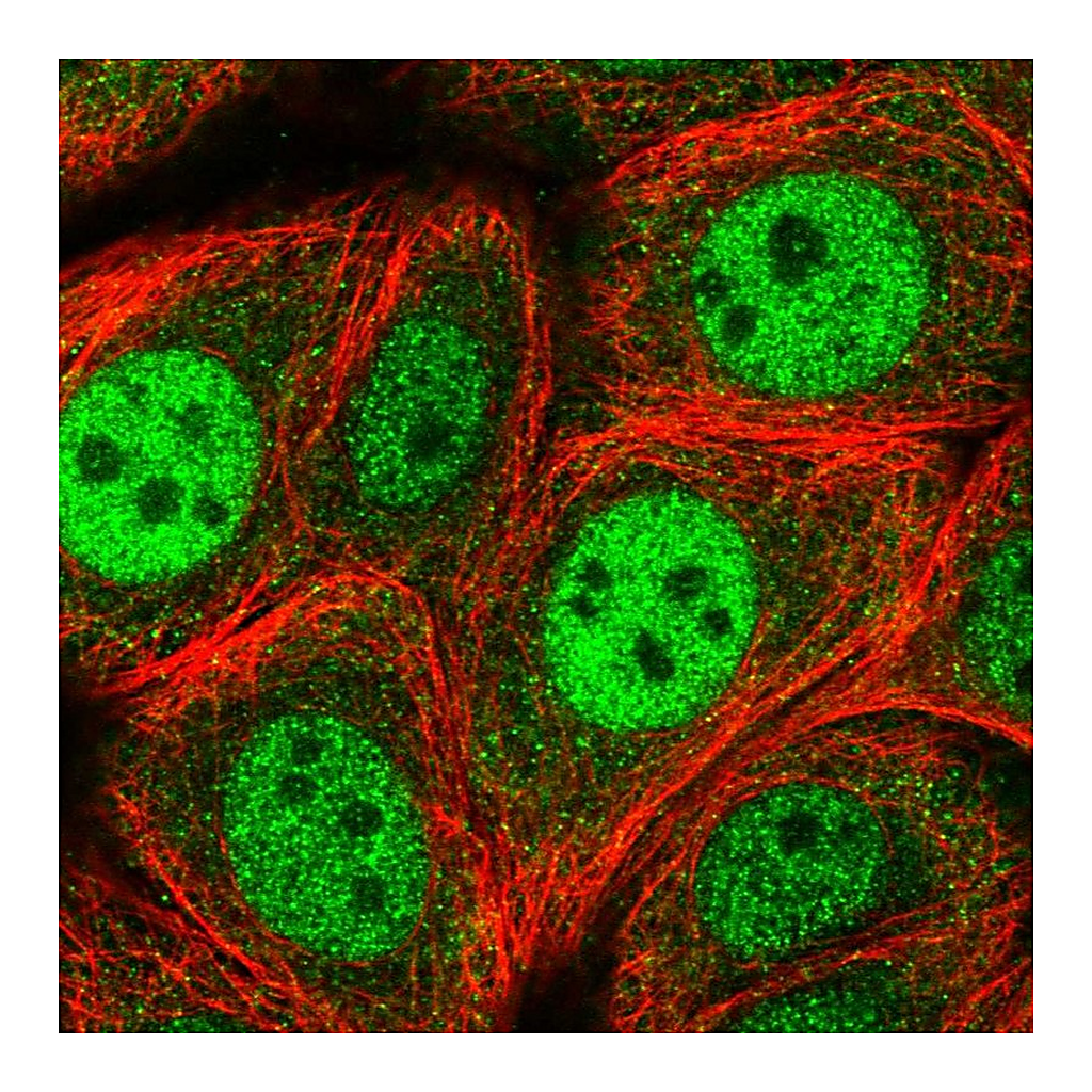Atlas Antibodies Anti-RGS3 Antibody