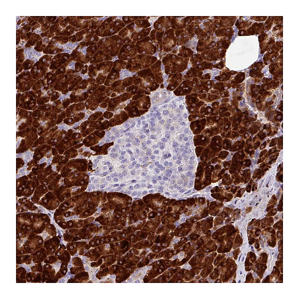 Atlas Antibodies Anti-RGS21 Antibody