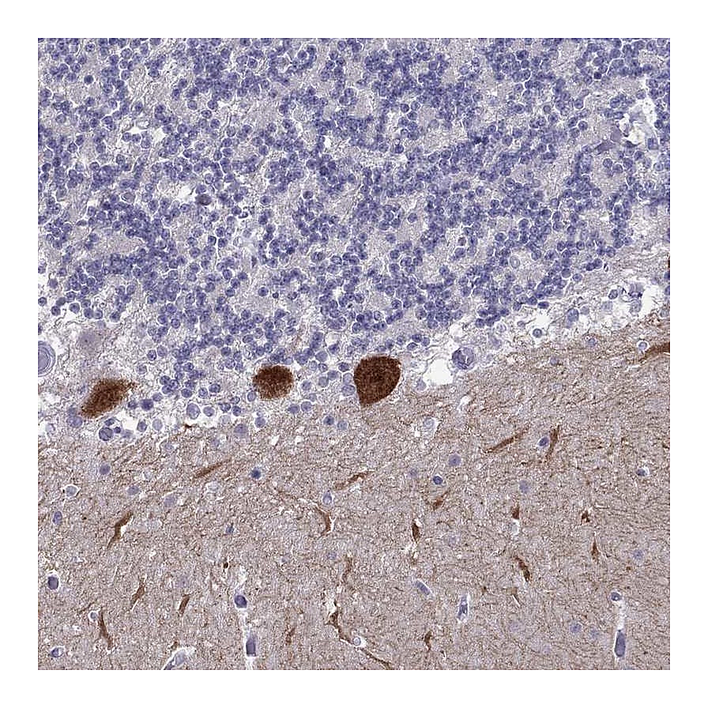 Atlas Antibodies Anti-RGS8 Antibody
