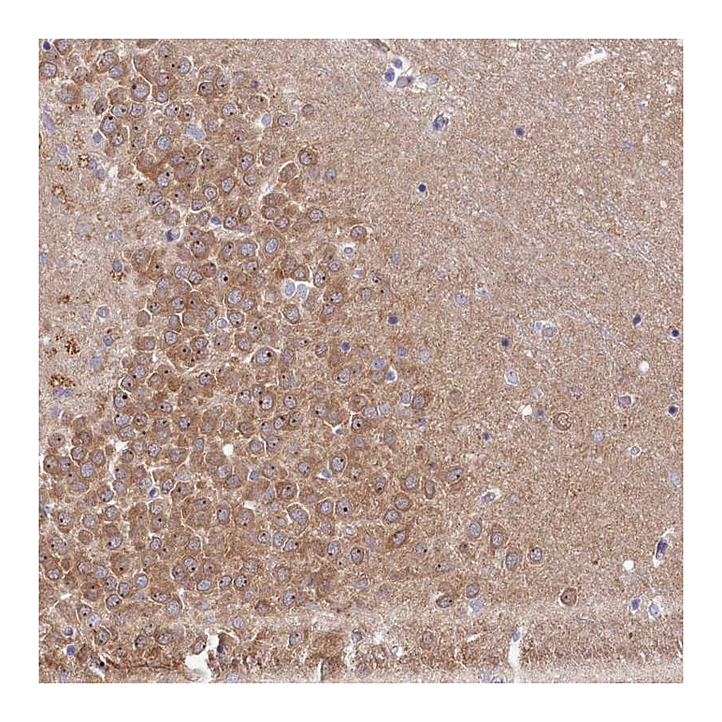 Atlas Antibodies Anti-RGS7BP Antibody