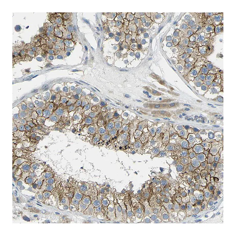 Atlas Antibodies Anti-RHBDD1 Antibody
