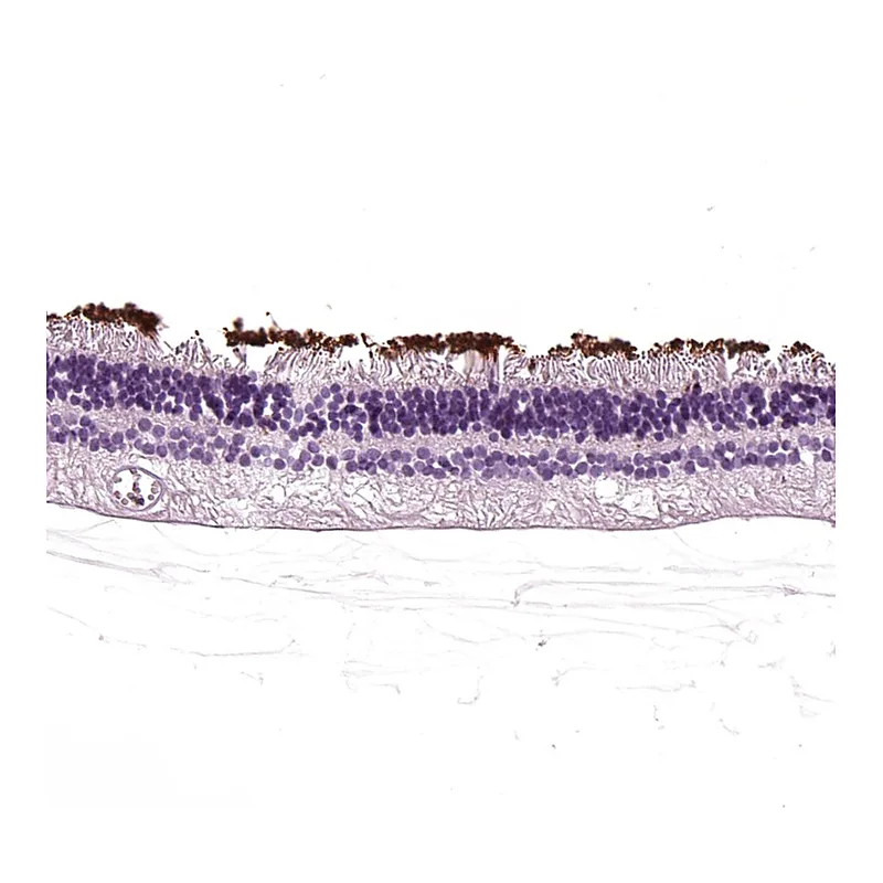 Atlas Antibodies Anti-RHO Antibody